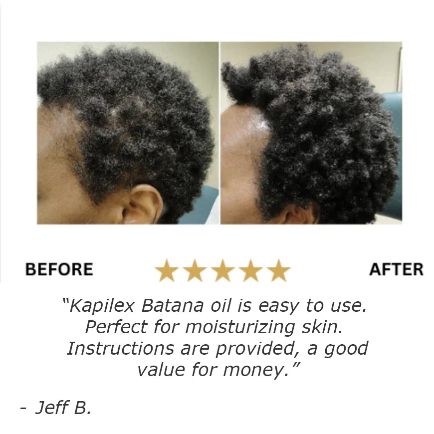 Batana Natural Hair Growth Oil