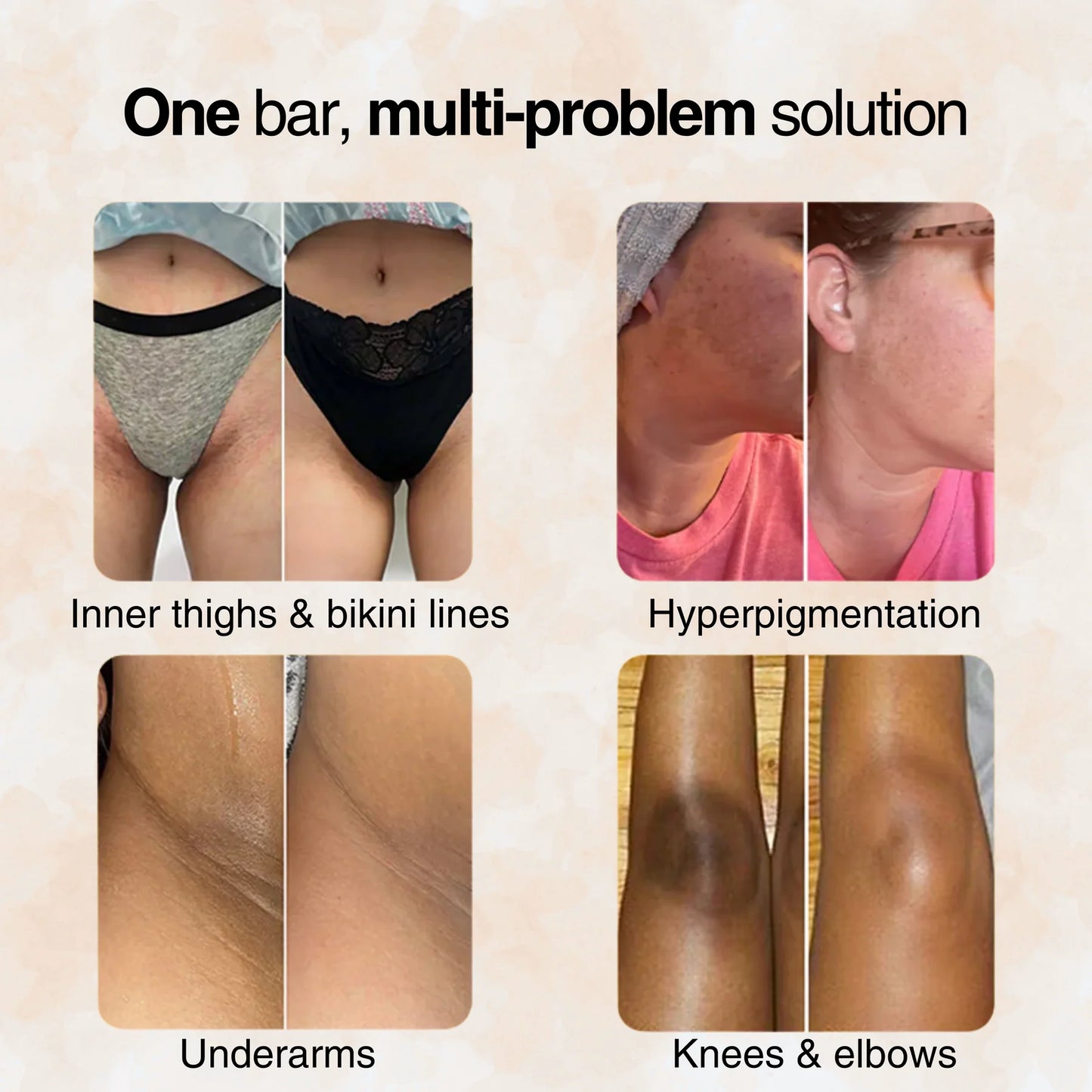 Advanced Turmeric & Kojic Acid Soap